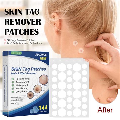 Sertifikat, penghargaan, tanda, atau dokumen yang dipajang di top up point Ahli Skin Pattern Index paling praktis penasaran patch